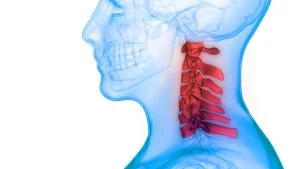 How Much Does Cervical Disc Surgery Cost in Egypt?