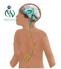 سعر جهاز الشنط الدماغي