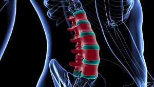 مضاعفات الانزلاق الغضروف القطني  