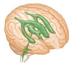 جراحات بطينات المخ بالميكروسكوب