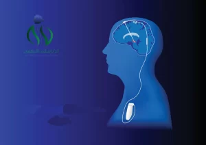  لماذا يتم التحفيز العميق للدماغ dbs ؟