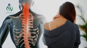 تشخيص الإنزلاق الغضروفي العنقي 