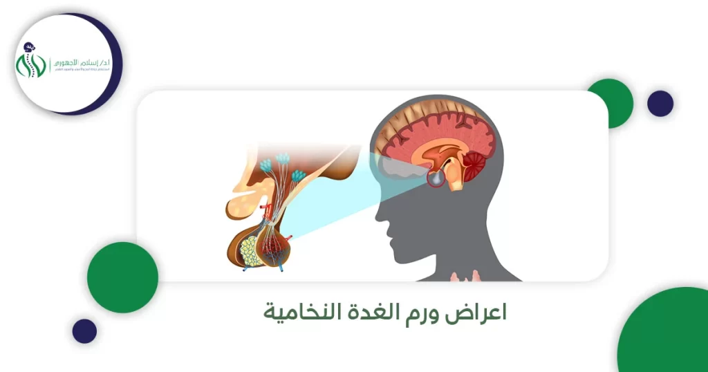 اعراض ورم الغدة النخامية