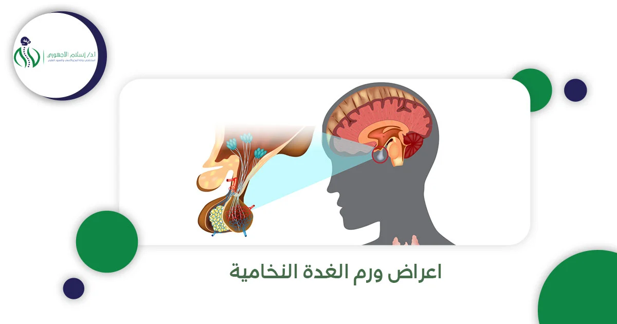 اعراض ورم الغدة النخامية