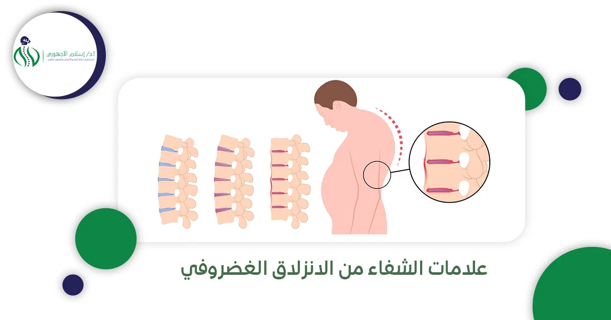 علامات الشفاء من الانزلاق الغضروفي 