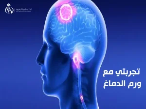 تجربتي مع ورم الدماغ