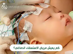 كم يعيش مريض الاستسقاء الدماغي